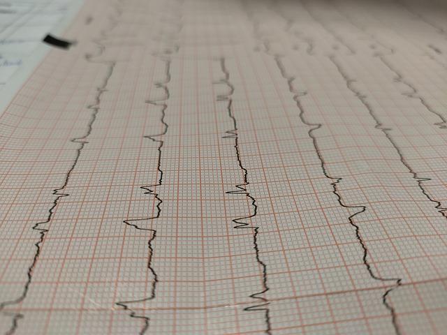 Jak Dlouho Se Marodí Po Infarktu: Co Očekávat Po Návratu Domů?