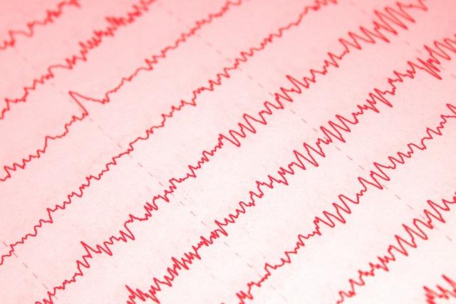 Vyšetření EEG‌ jako pomocná metoda diagnostiky Parkinsonovy nemoci